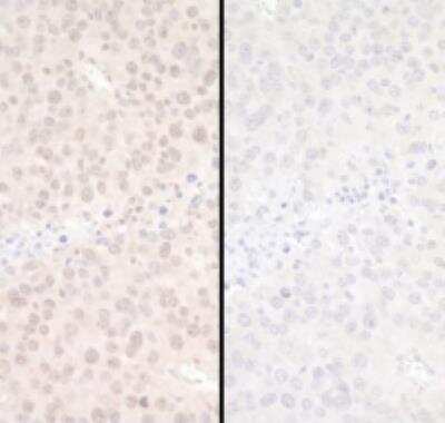 Immunohistochemistry-Paraffin: EZH2/KMT6 [p Ser21] Antibody [NBP1-18935] - FFPE serial sections of mouse renal cell carcinoma. Mock phosphatase treatedsection (left) and calf intestinal phosphatase-treated section (right). Antibody: Affinity purified rabbit anti-PhosphoEZH2 (S21) sed at a dilution of 1:250. Detection: DAB